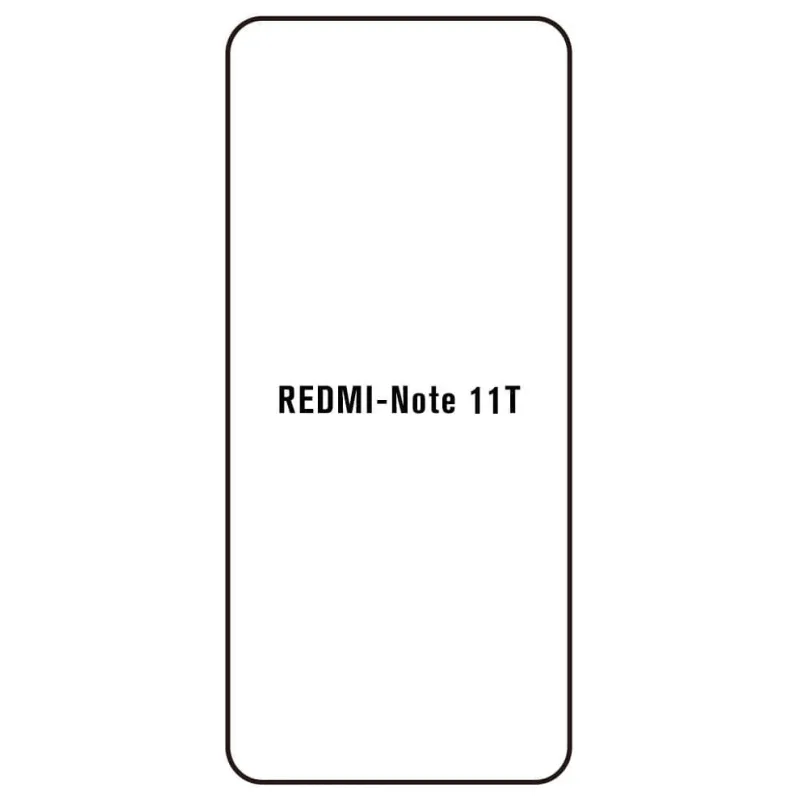 Sunshine Xiaomi Redmi Note 11T 5G Predná Hydrogél ochranná fólia Strih: Predná 2, Typ fólie: Anti-Spy (Privacy)